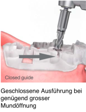 Geschlossene Bohrerführung