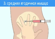 image answer choice
